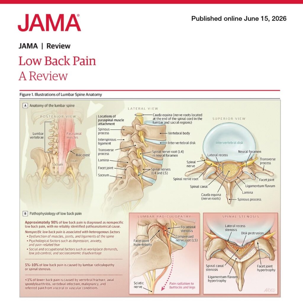 Patient receiving evaluation and conservative treatment for low back pain, highlighting movement, exercise, and spinal manipulation.